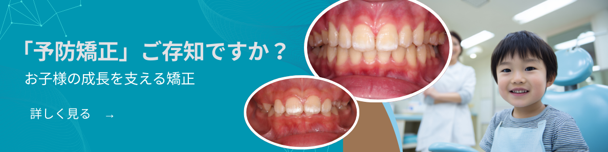 シークエンシャル咬合について